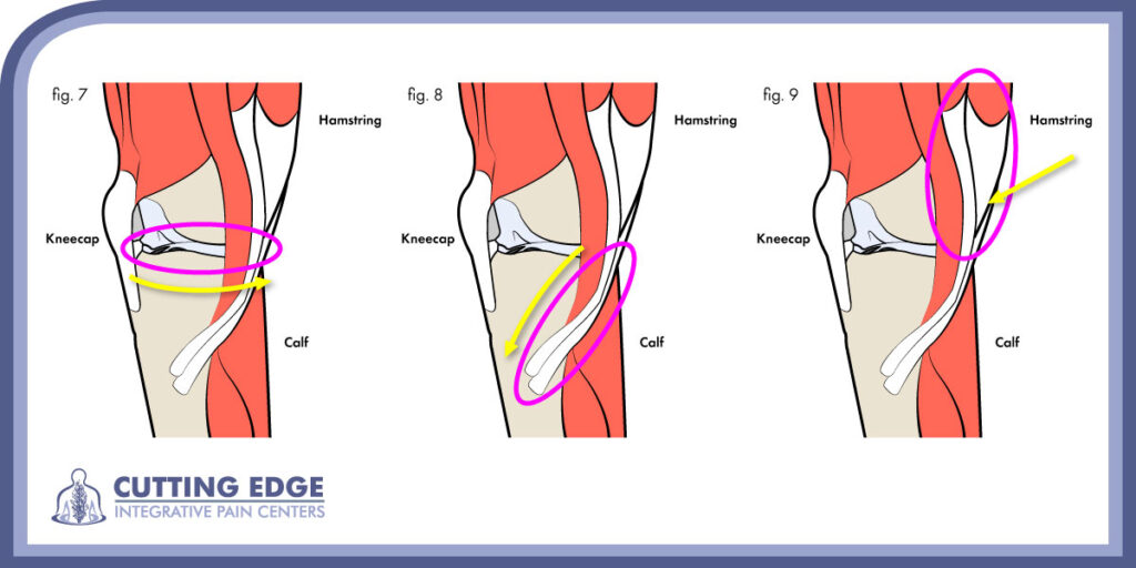 Diagnosing knee pain