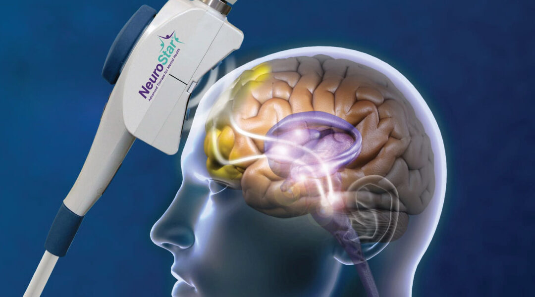 What Is TMS and NeurStar?